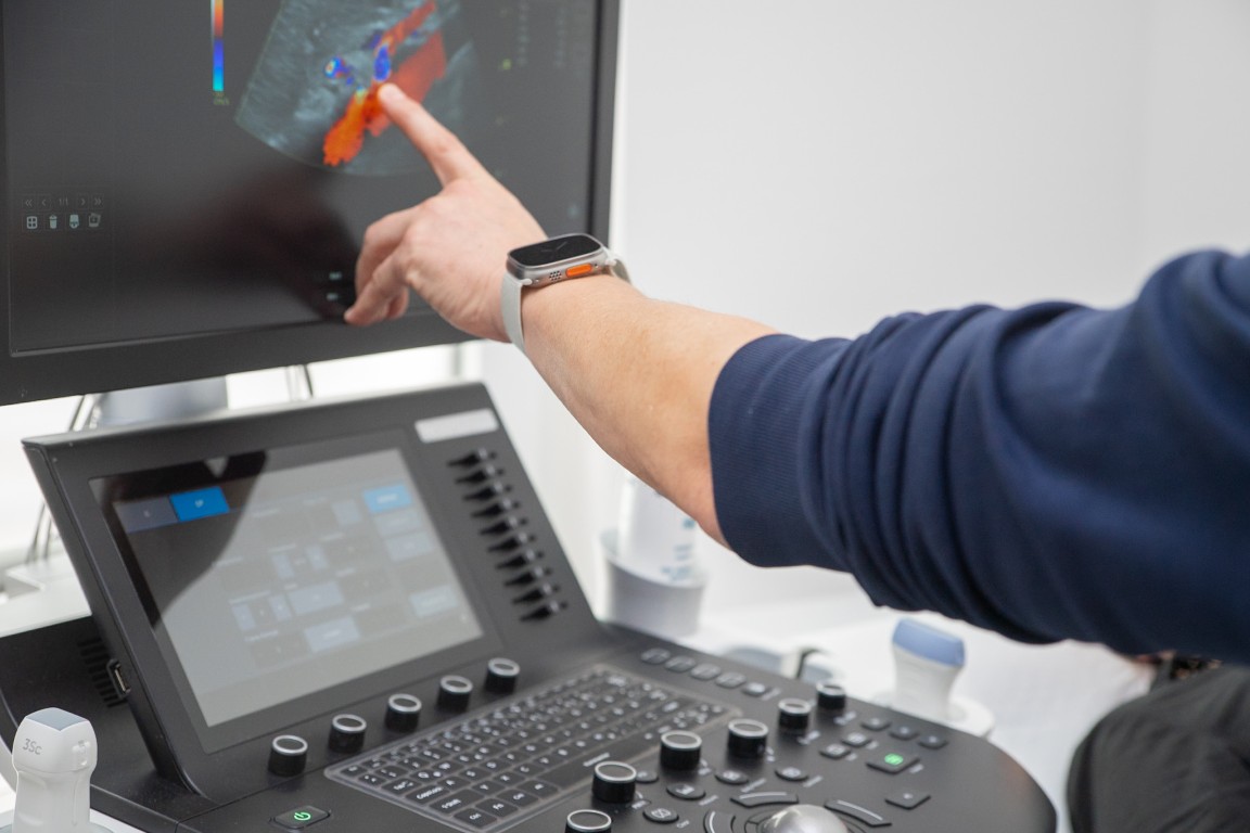 Untersuchung Bauchgefäße mit Farbduplex